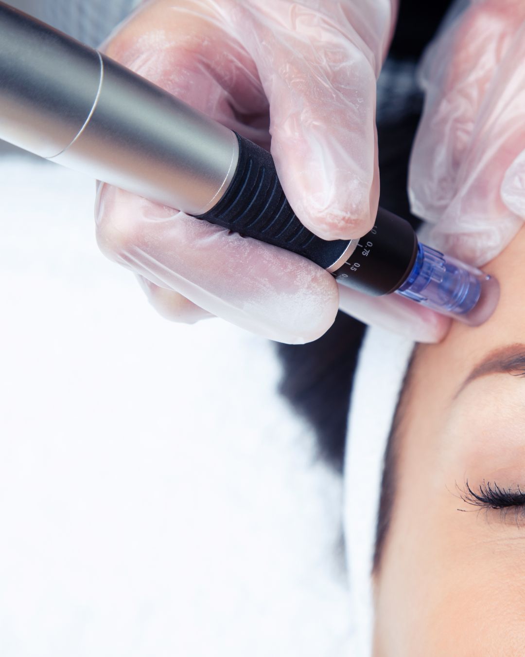 Dermapen Medik8