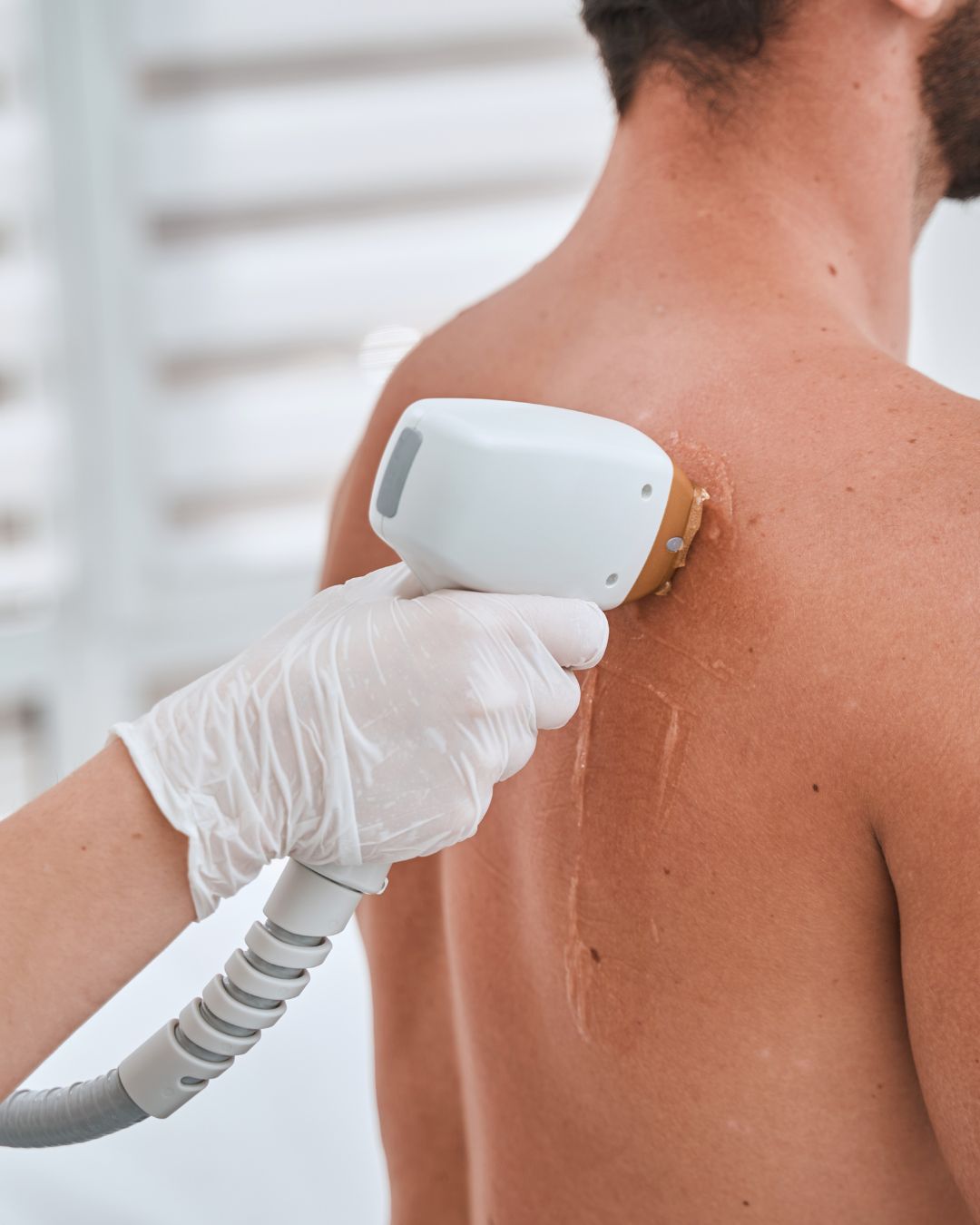 Ανδρικός Κορμός Laser